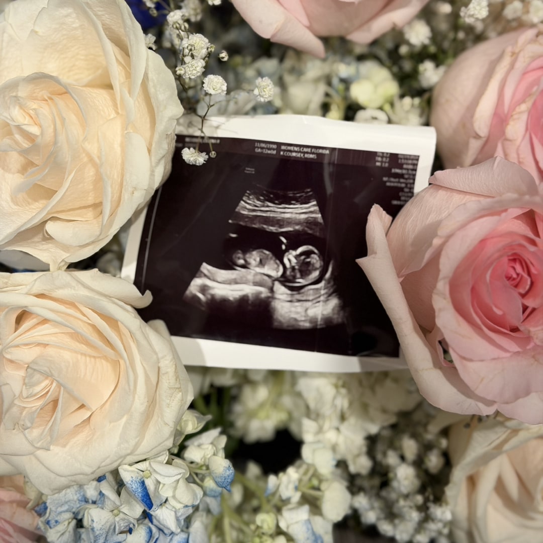 Photo shared by Baby A for their Babylist baby registry.