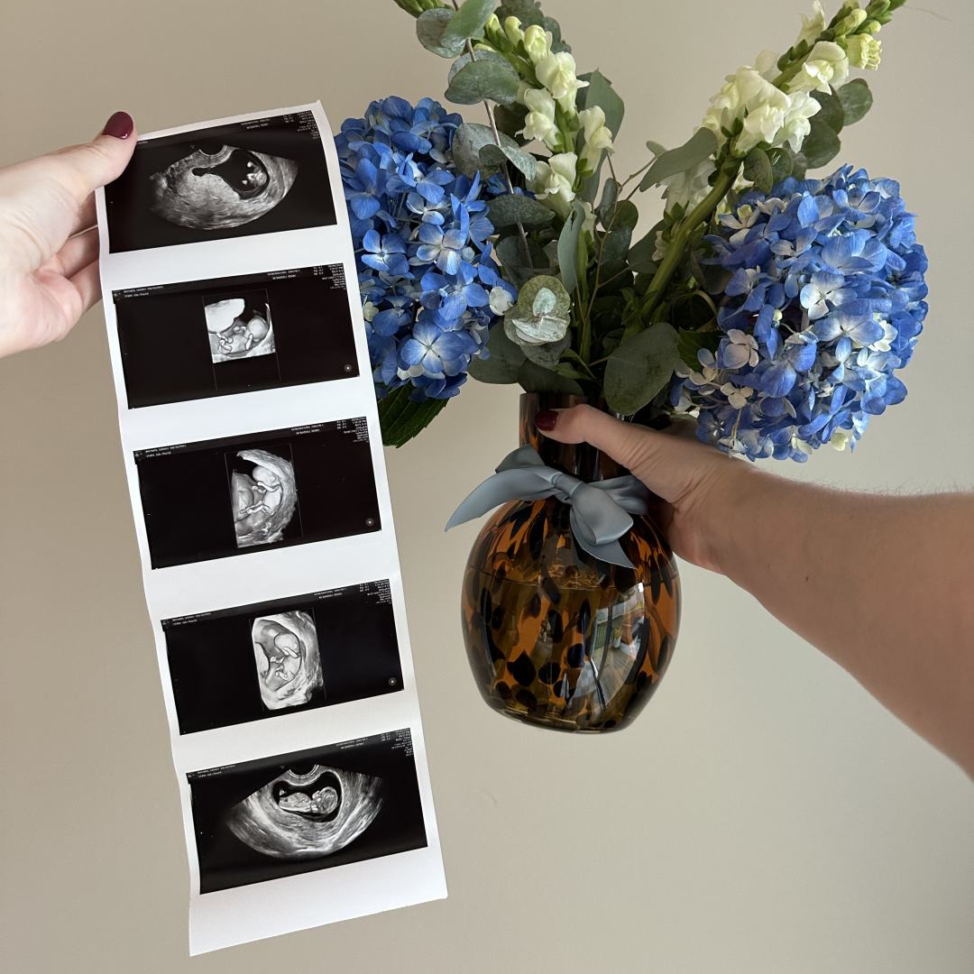 Photo shared by Sarah for their Babylist baby registry.