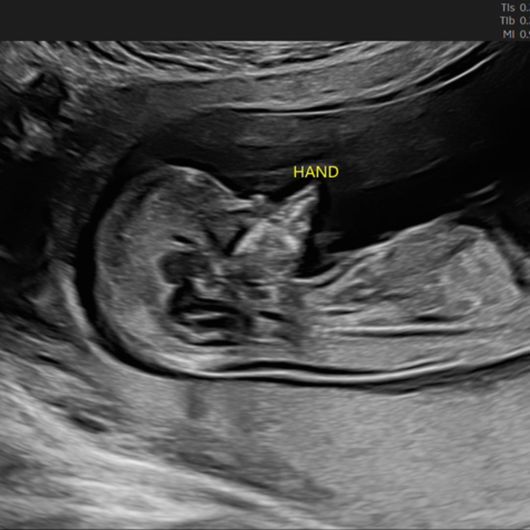 Photo shared by Stephen for their Babylist baby registry.