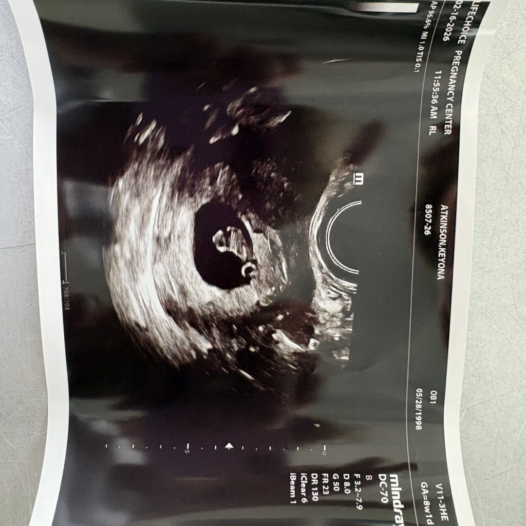 Photo shared by Keyona for their Babylist baby registry.