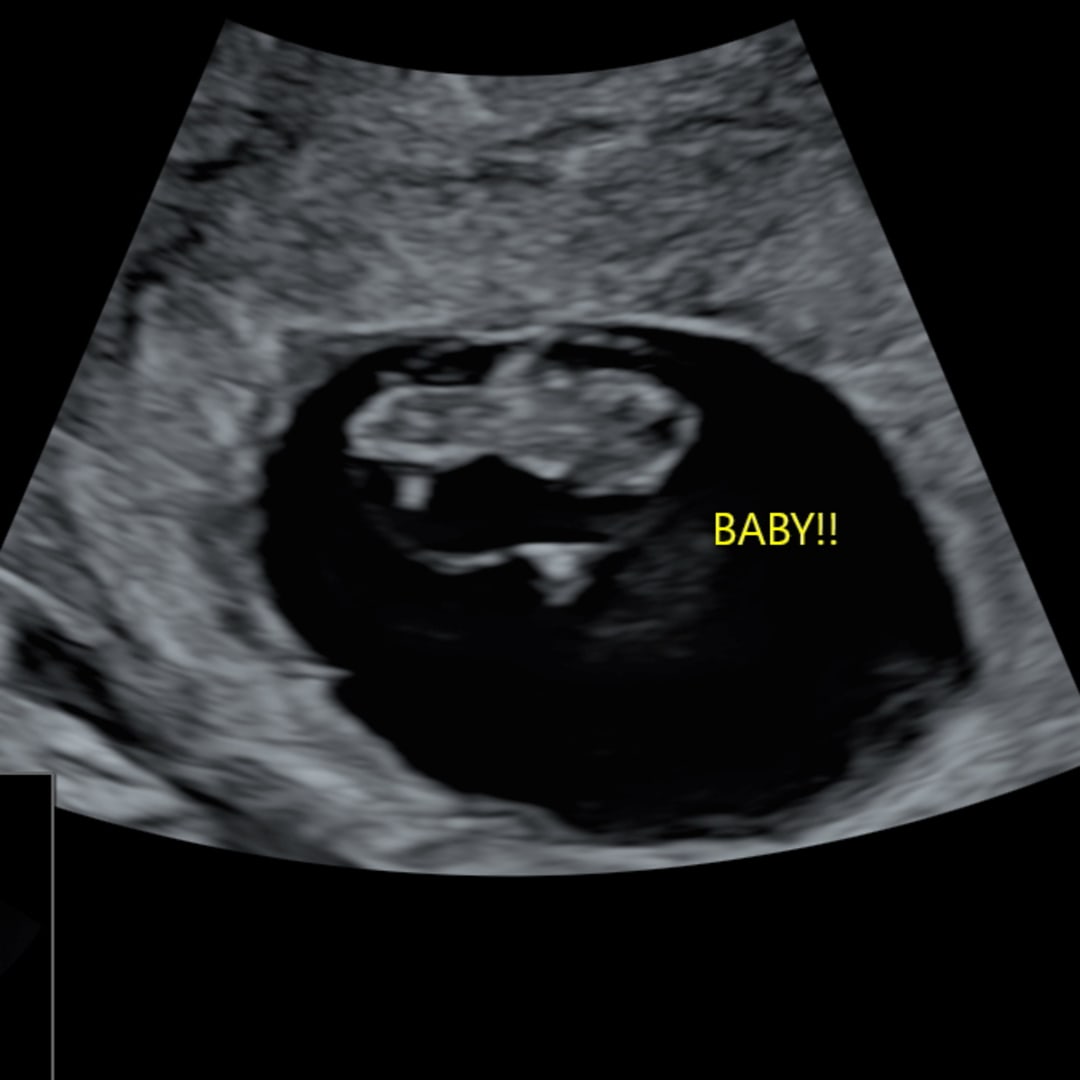 Photo shared by Michaela for their Babylist baby registry.