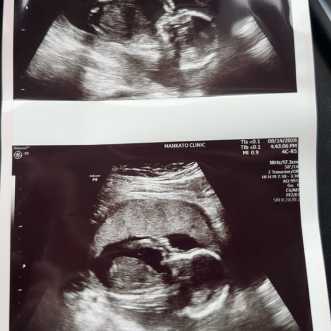 Photo shared by Sierra for their Babylist baby registry.