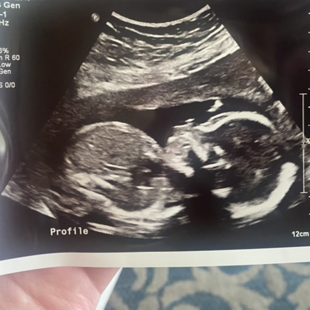 Photo shared by Molly for their Babylist baby registry.