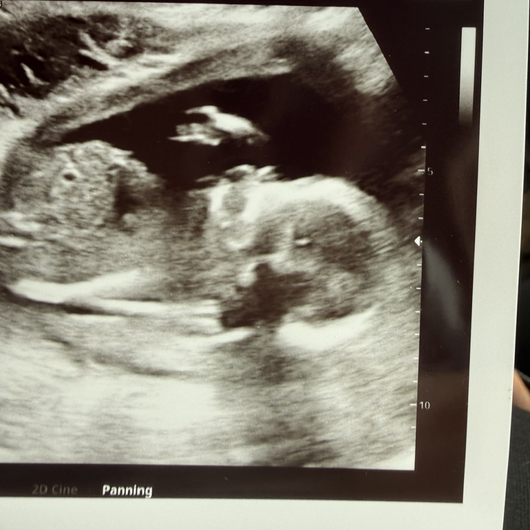 Photo shared by Julisa for their Babylist baby registry.