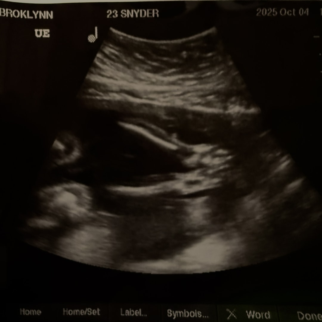 Photo shared by Brooklynn for their Babylist baby registry.