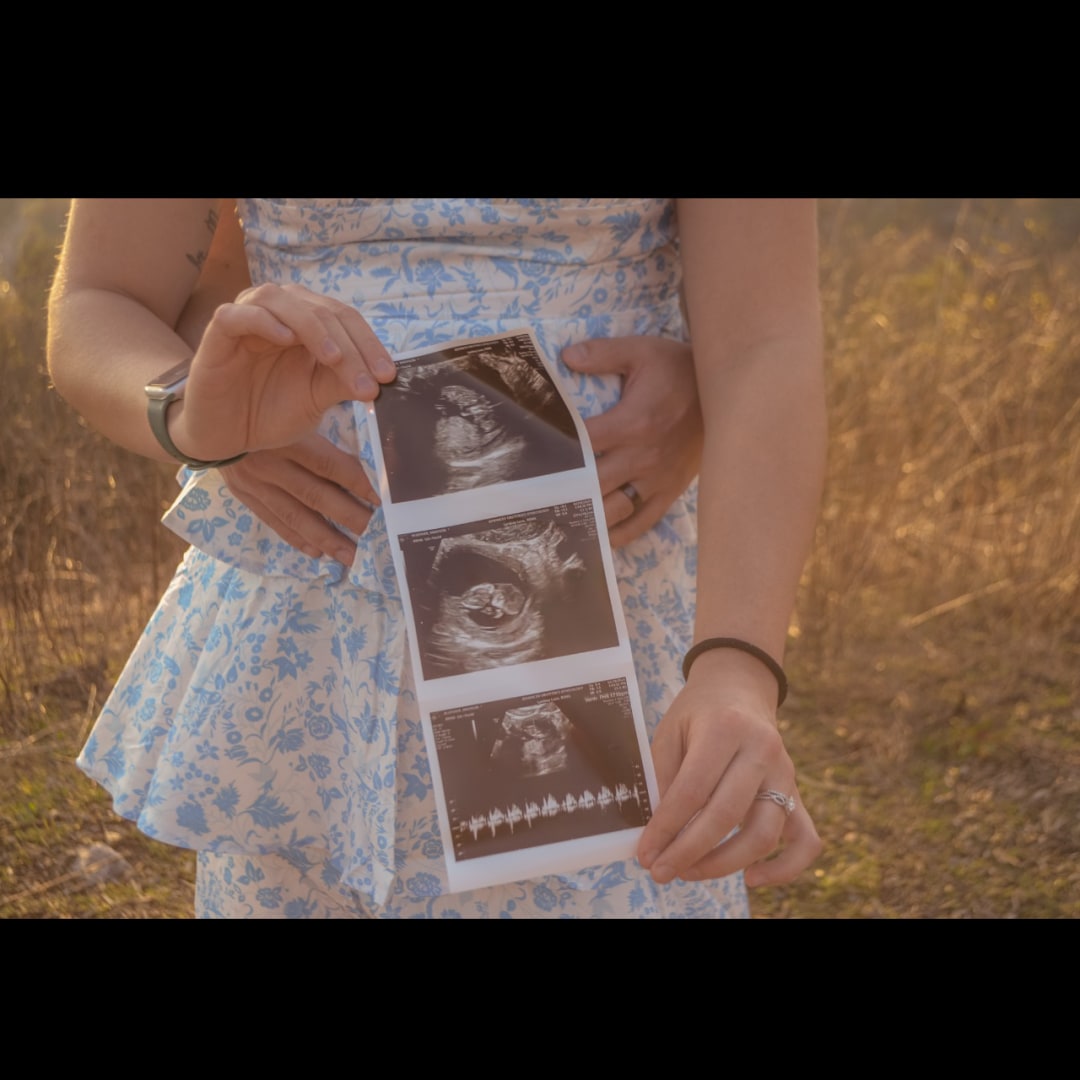 Photo shared by Madison for their Babylist baby registry.