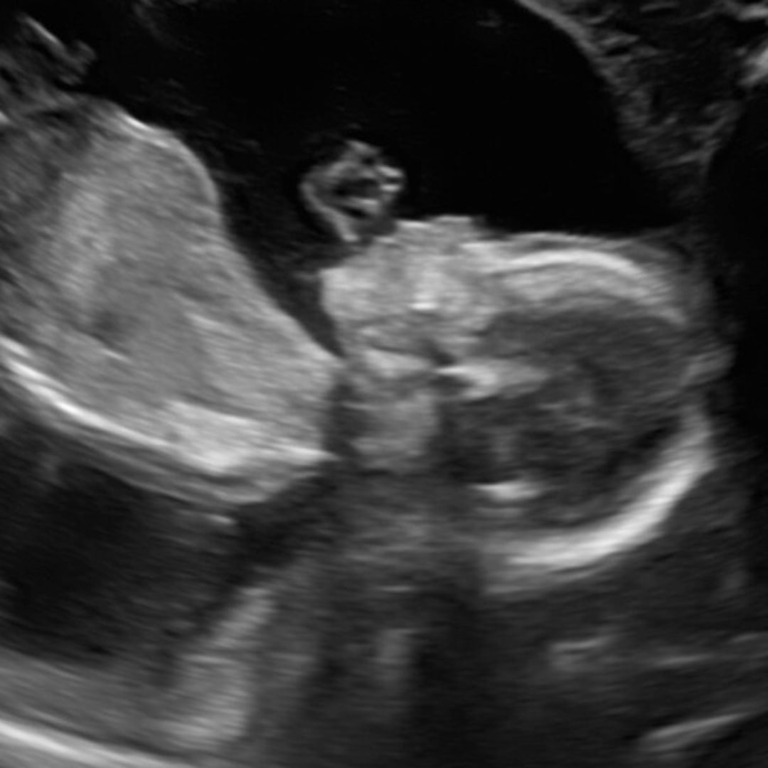 Photo shared by Jaden for their Babylist baby registry.