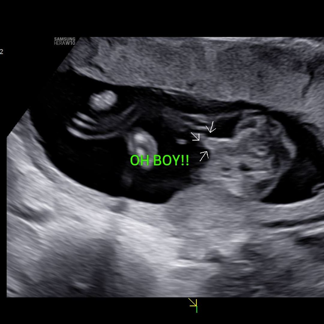 Photo shared by Sherry for their Babylist baby registry.