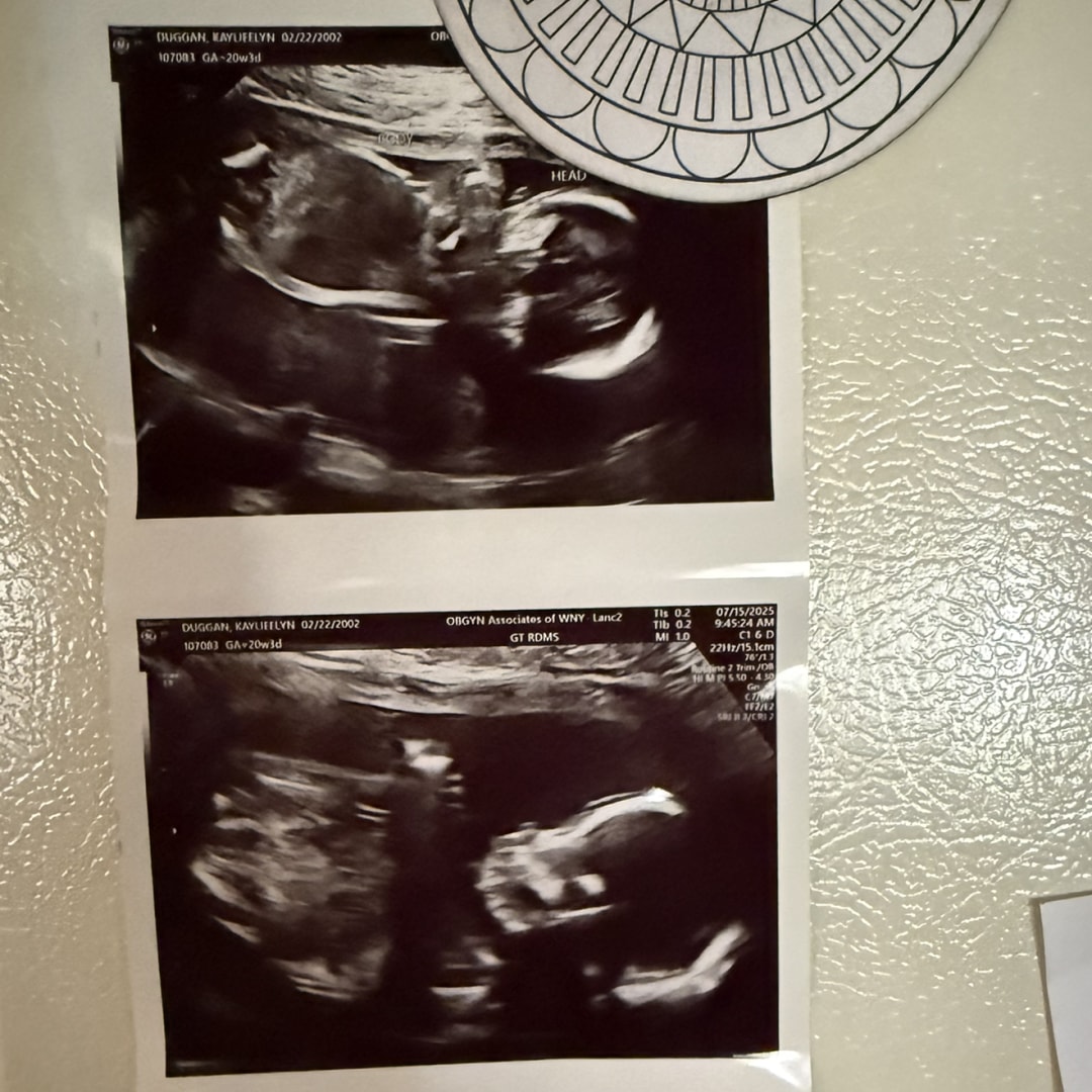 Photo shared by Kaylieelynn for their Babylist baby registry.