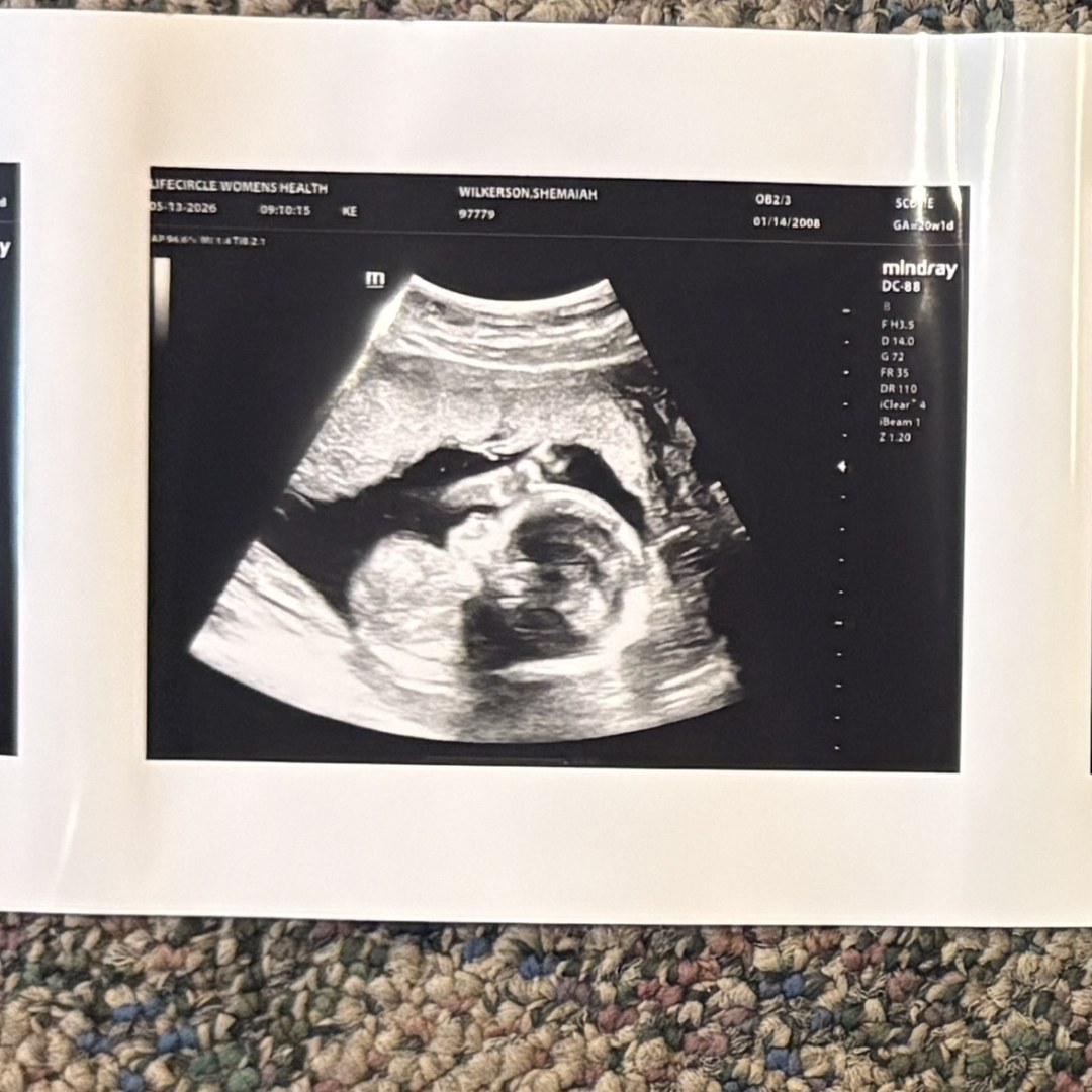 Photo shared by Shemaiah for their Babylist baby registry.