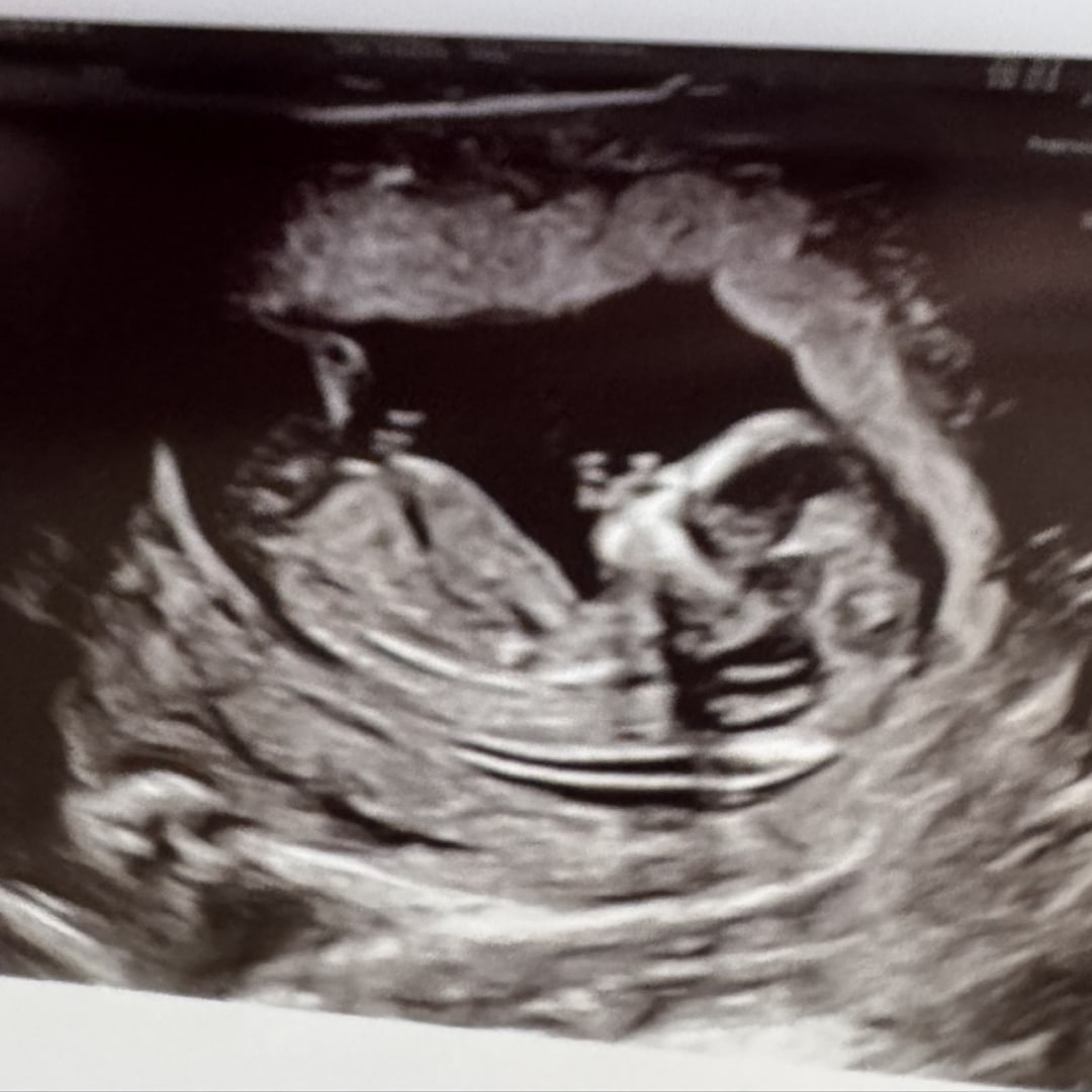 Photo shared by Grace for their Babylist baby registry.