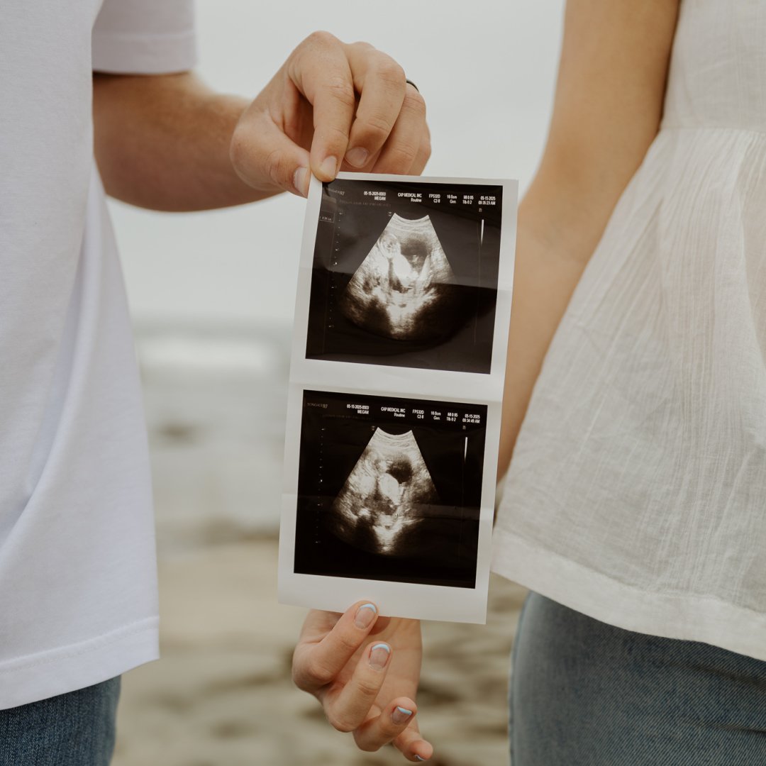 Photo shared by Megan for their Babylist baby registry.