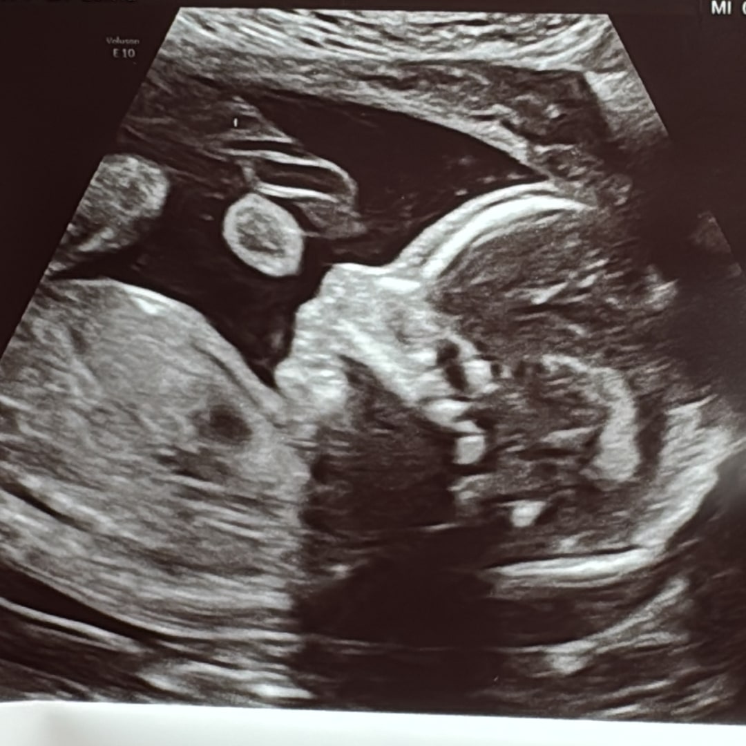 Photo shared by Danielle for their Babylist baby registry.