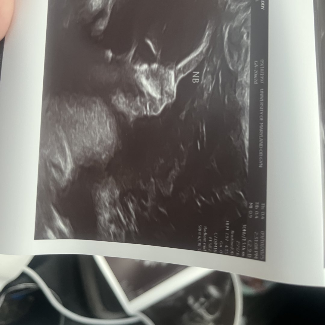 Photo shared by Melody for their Babylist baby registry.