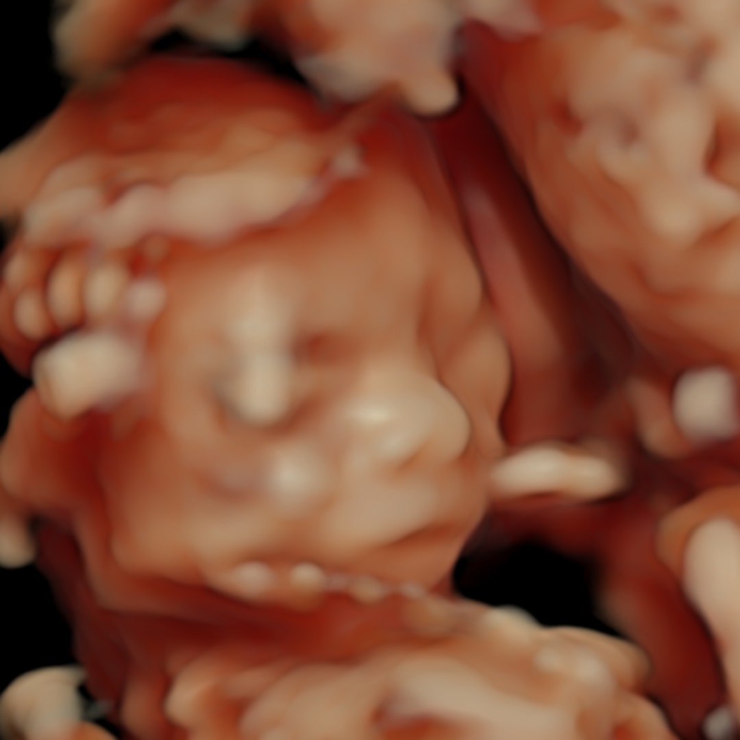 Photo shared by Desa for their Babylist baby registry.