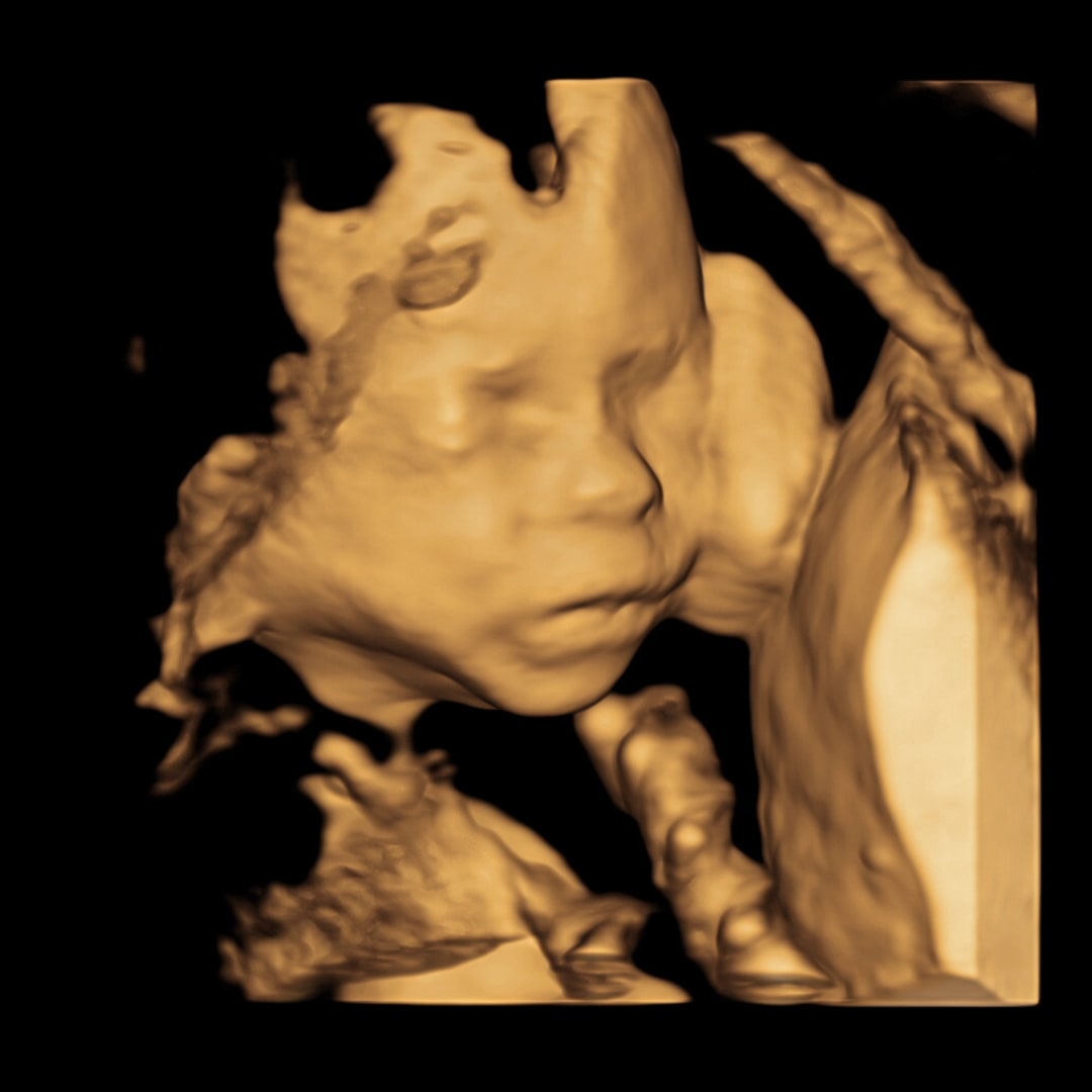 Photo shared by Allie for their Babylist baby registry.