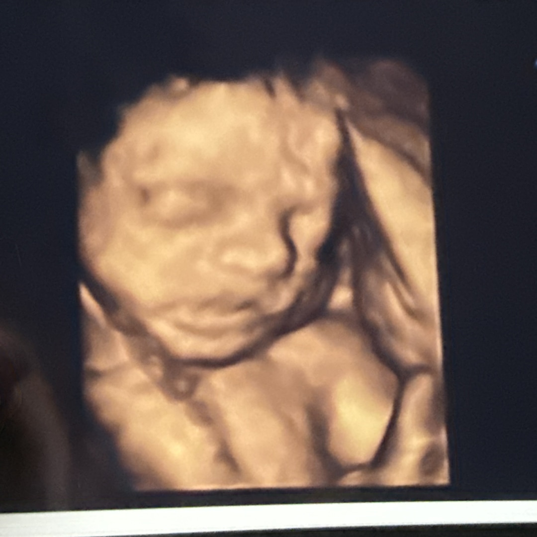 Photo shared by Jennifer for their Babylist baby registry.