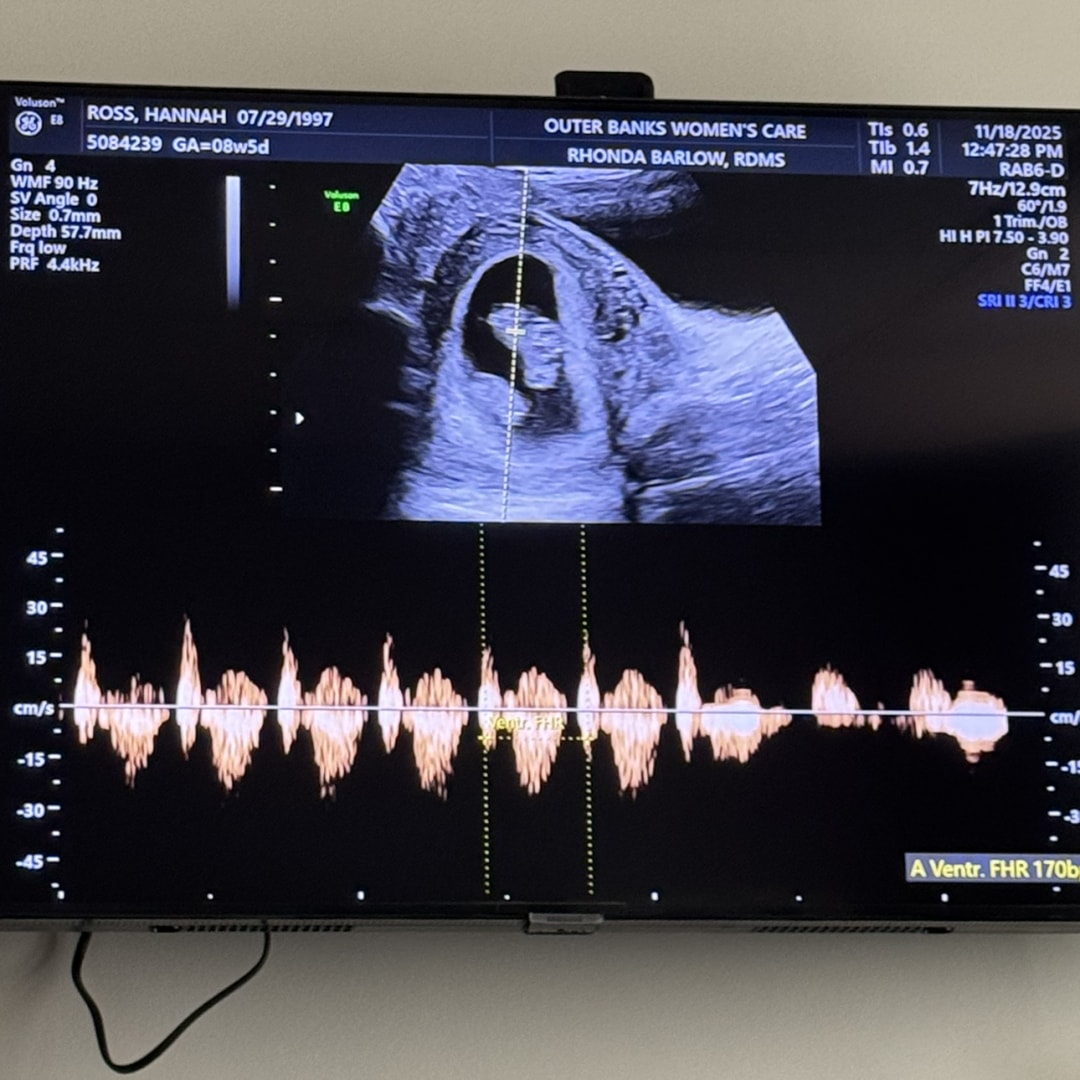 Photo shared by Hannah for their Babylist baby registry.