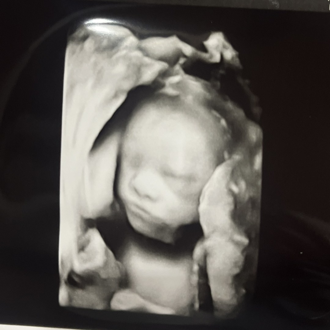 Photo shared by Alex for their Babylist baby registry.