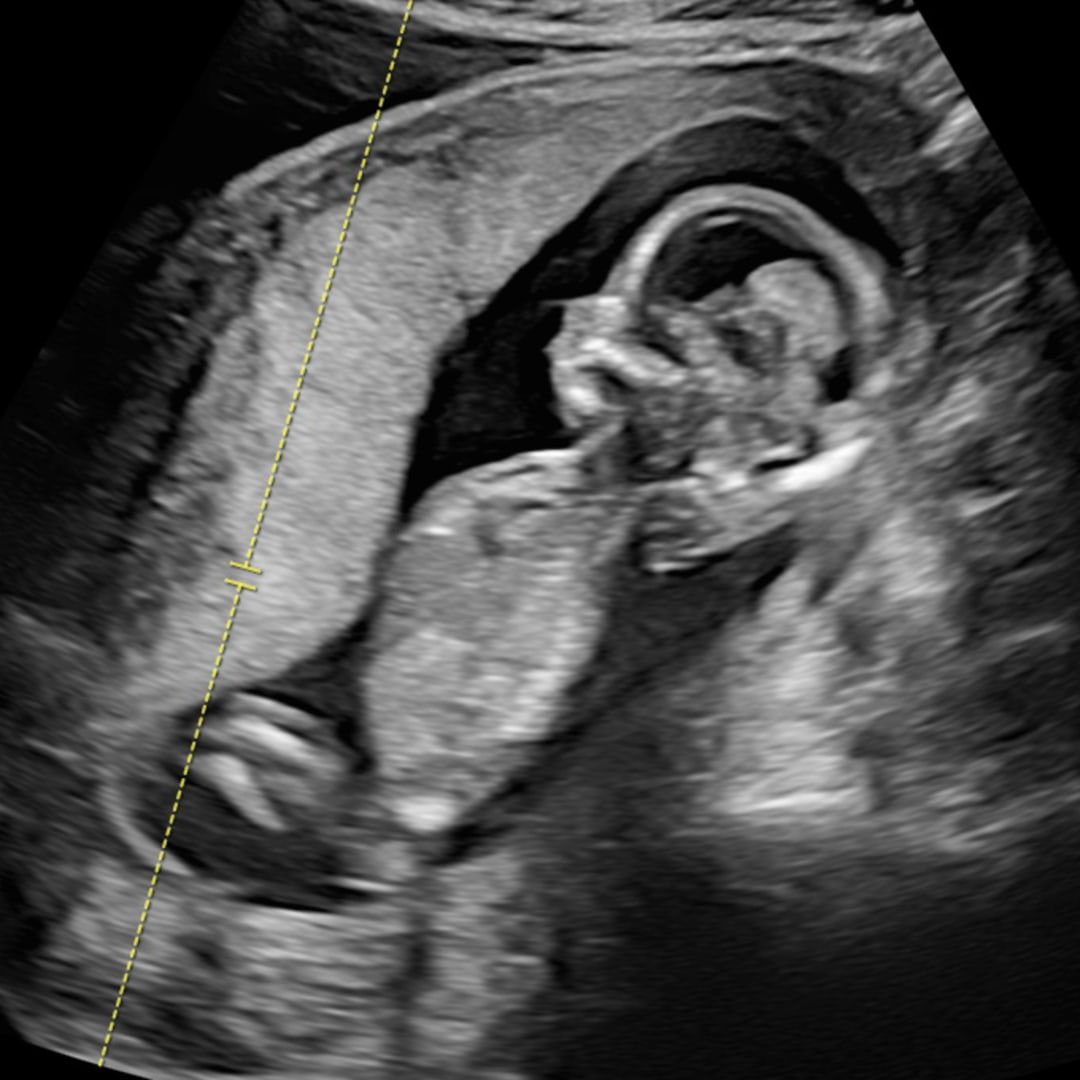 Photo shared by Katie for their Babylist baby registry.