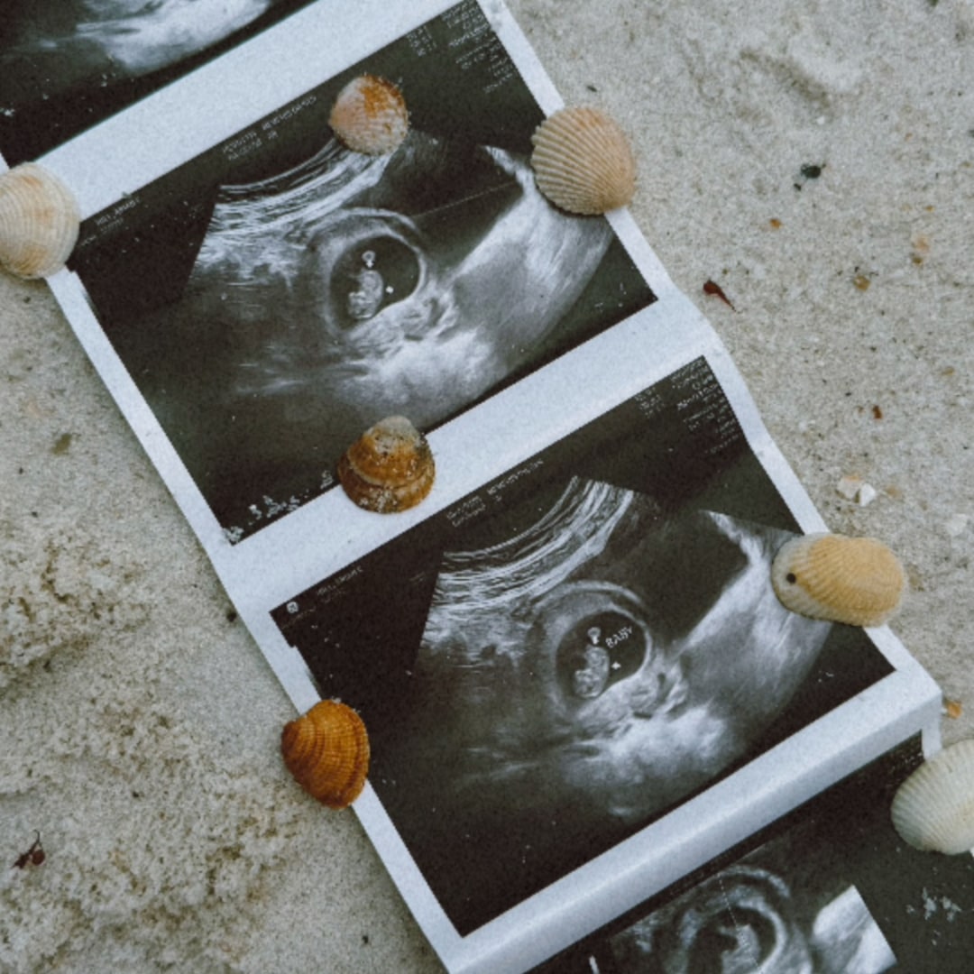Photo shared by Arian for their Babylist baby registry.