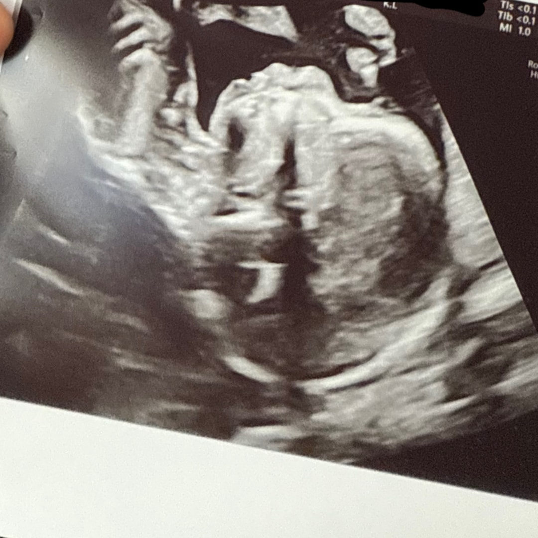 Photo shared by Darane for their Babylist baby registry.