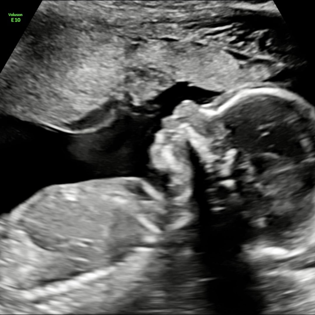 Photo shared by Monique for their Babylist baby registry.