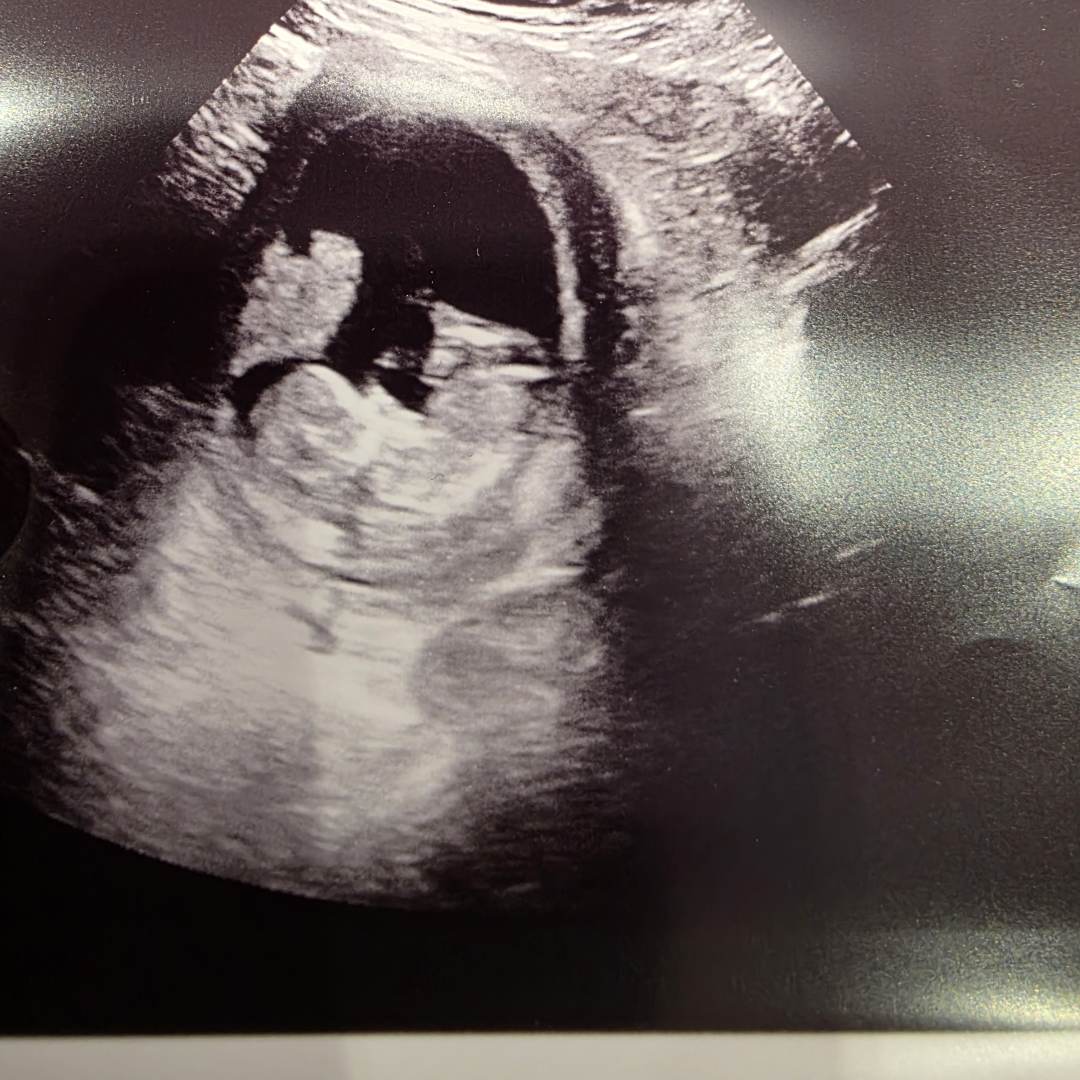 Photo shared by Michelle for their Babylist baby registry.