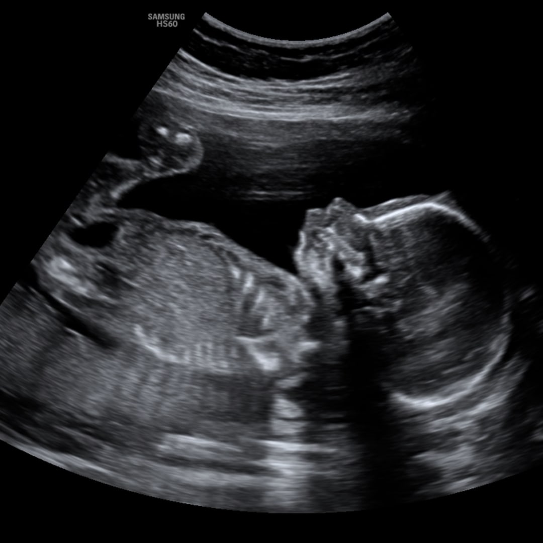 Photo shared by Alexandra for their Babylist baby registry.