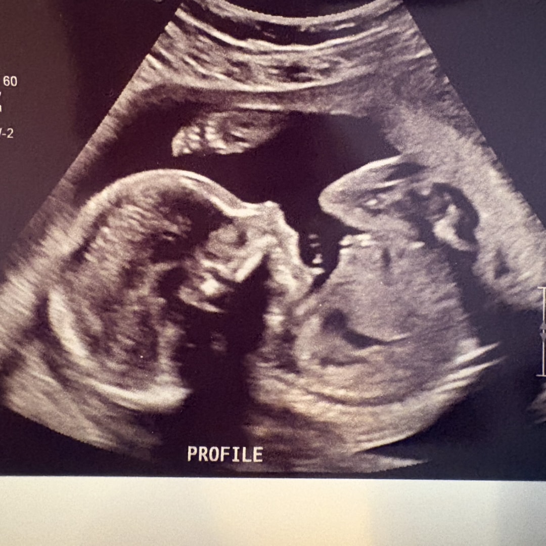 Photo shared by Alexandra for their Babylist baby registry.