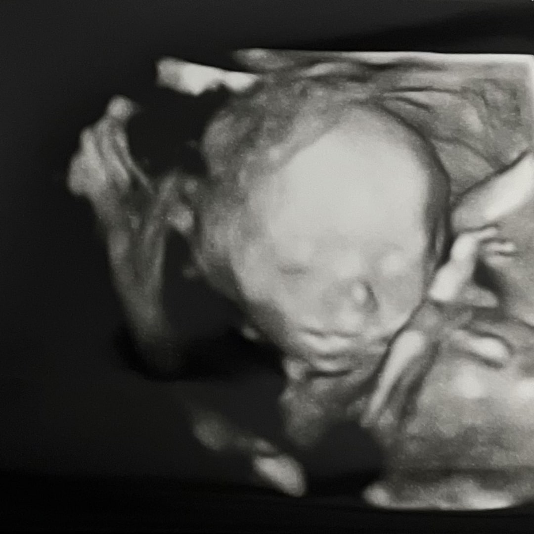Photo shared by Mary Beth for their Babylist baby registry.