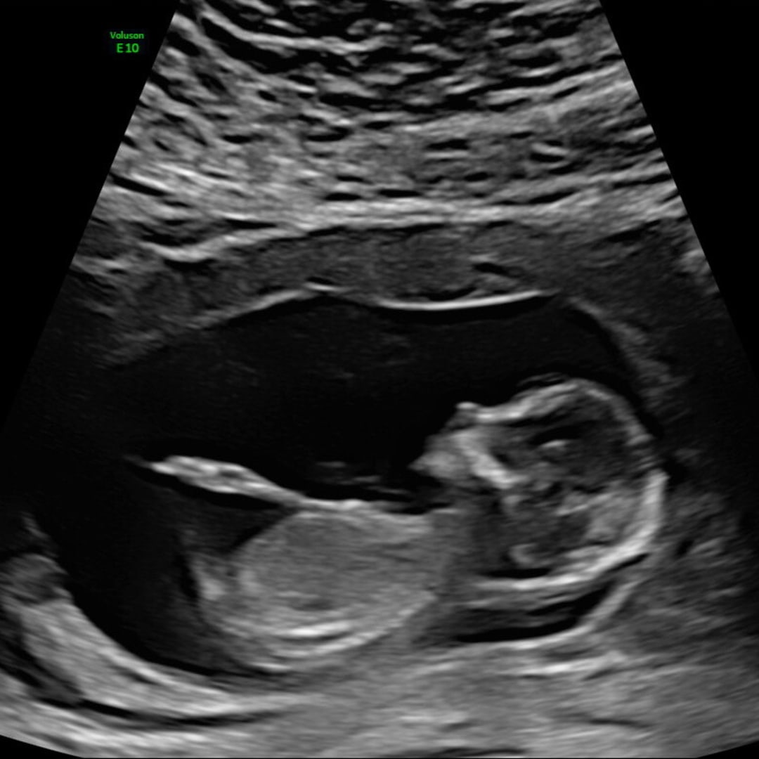 Photo shared by Emalie for their Babylist baby registry.