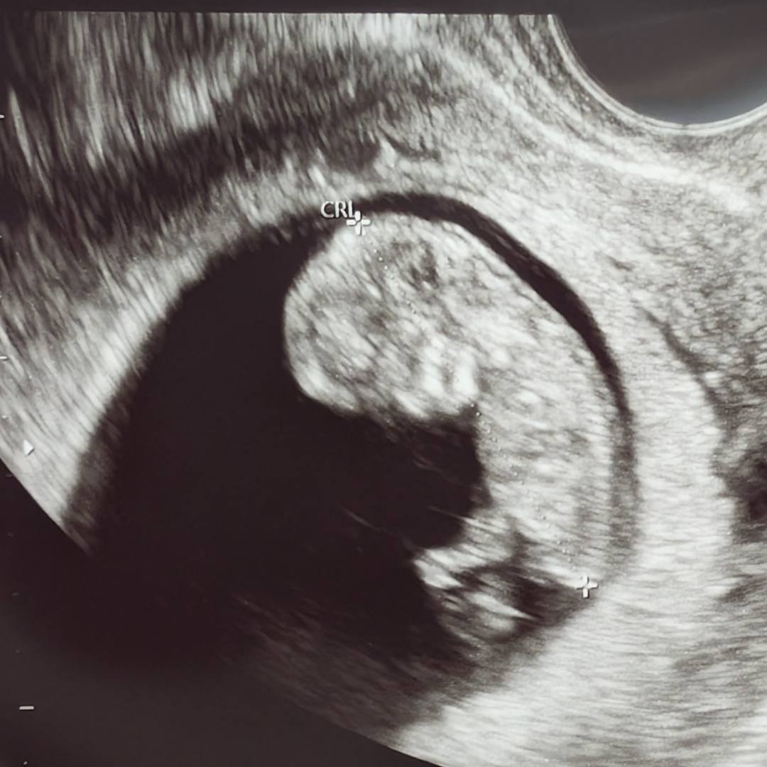 Photo shared by Keenan for their Babylist baby registry.