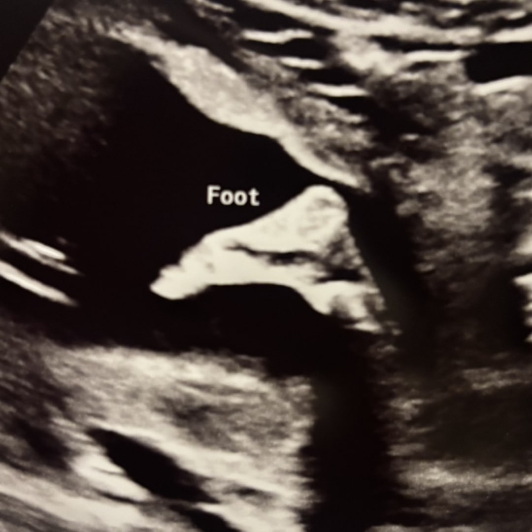 Photo shared by Stephanie for their Babylist baby registry.