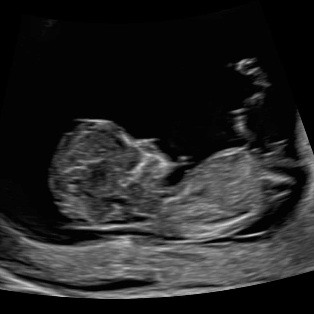 Photo shared by Stephanie for their Babylist baby registry.