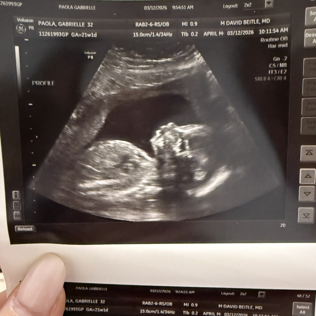 Photo shared by Gabrielle for their Babylist baby registry.