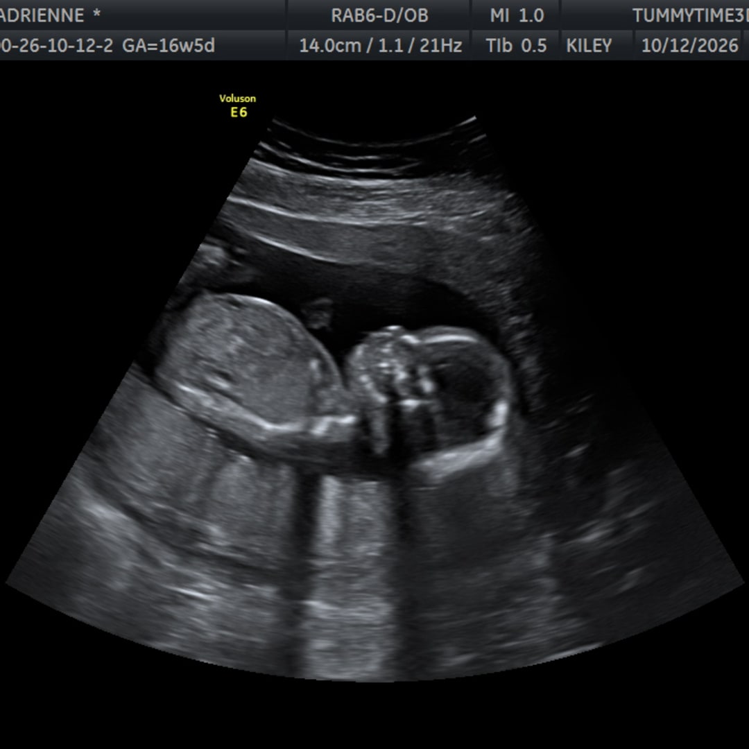 Photo shared by Adrienne for their Babylist baby registry.