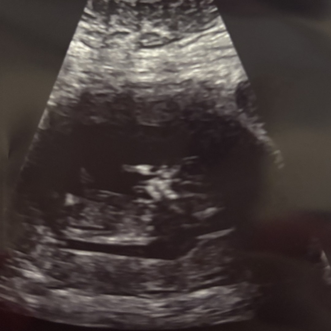 Photo shared by Kelsey for their Babylist baby registry.