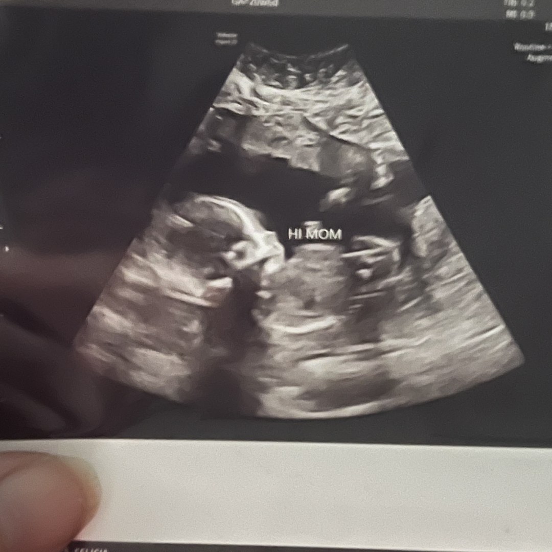 Photo shared by Felicia for their Babylist baby registry.
