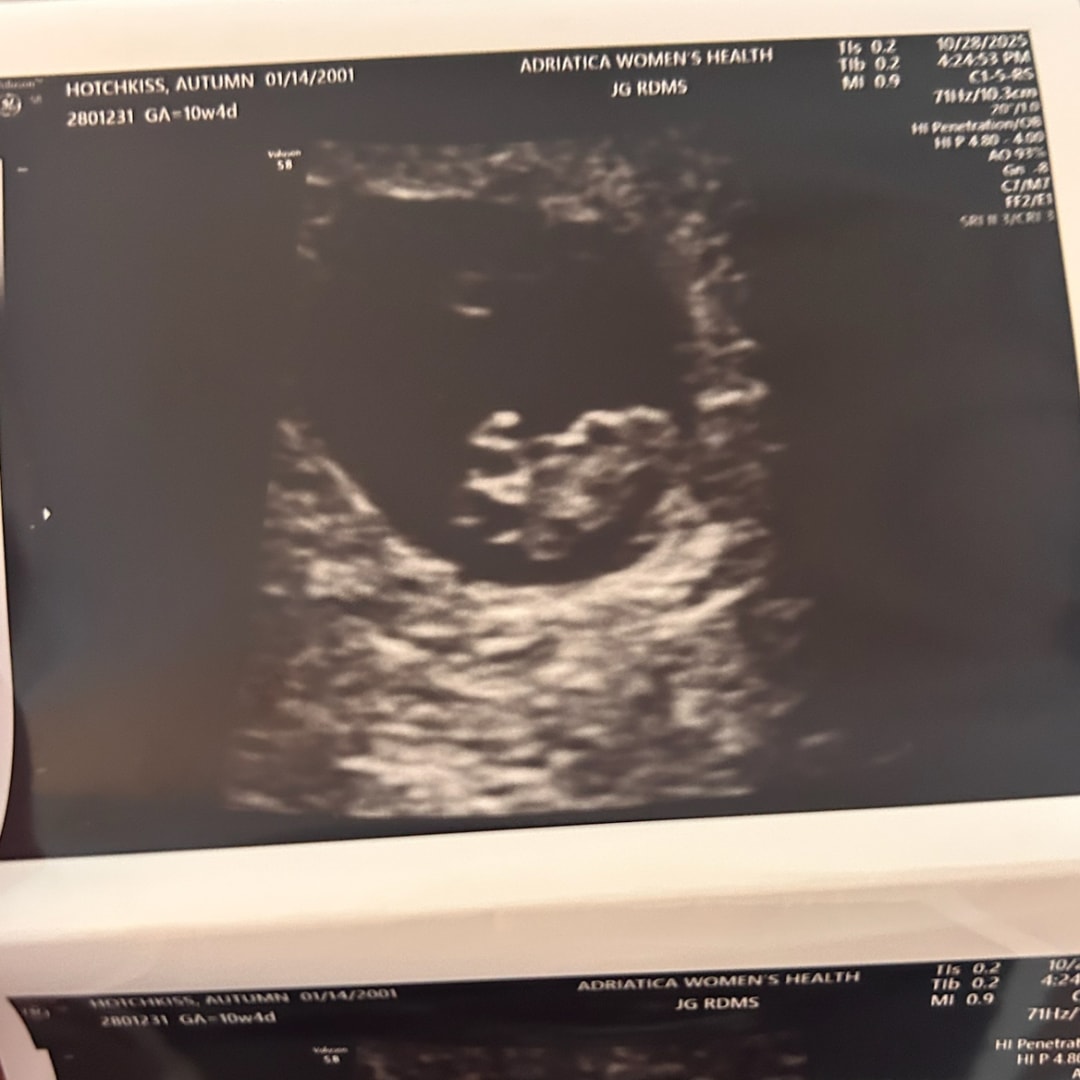 Photo shared by Autumn for their Babylist baby registry.