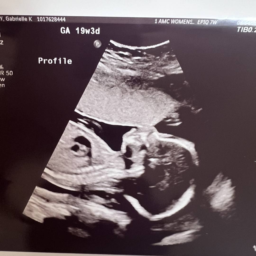 Photo shared by Gabrielle for their Babylist baby registry.