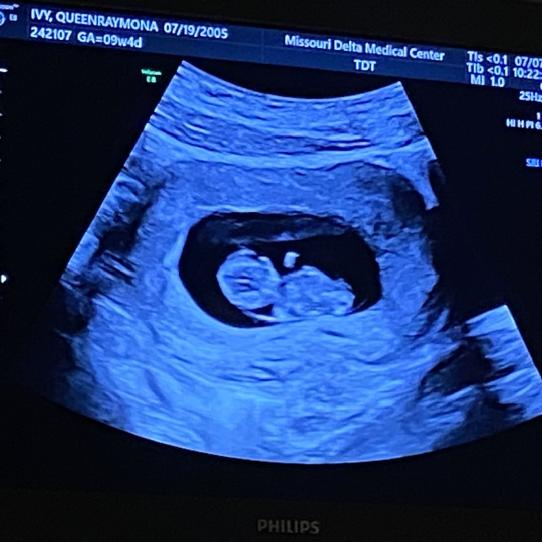 Photo shared by QueenRaymona for their Babylist baby registry.