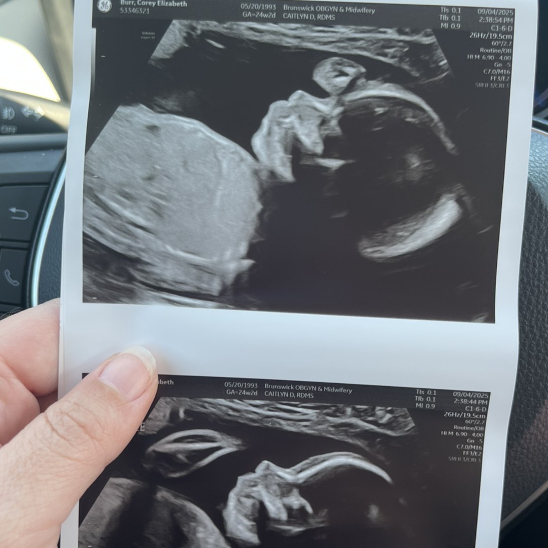 Photo shared by Corey for their Babylist baby registry.