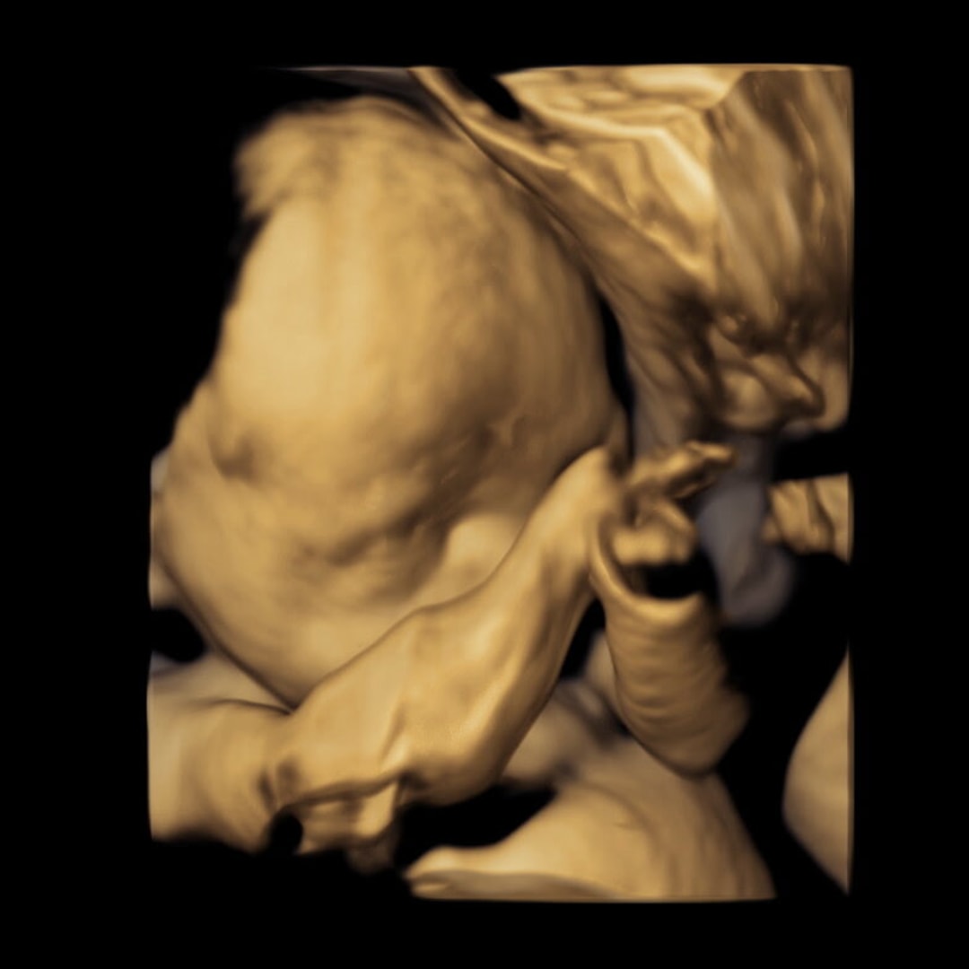 Photo shared by Sharan for their Babylist baby registry.