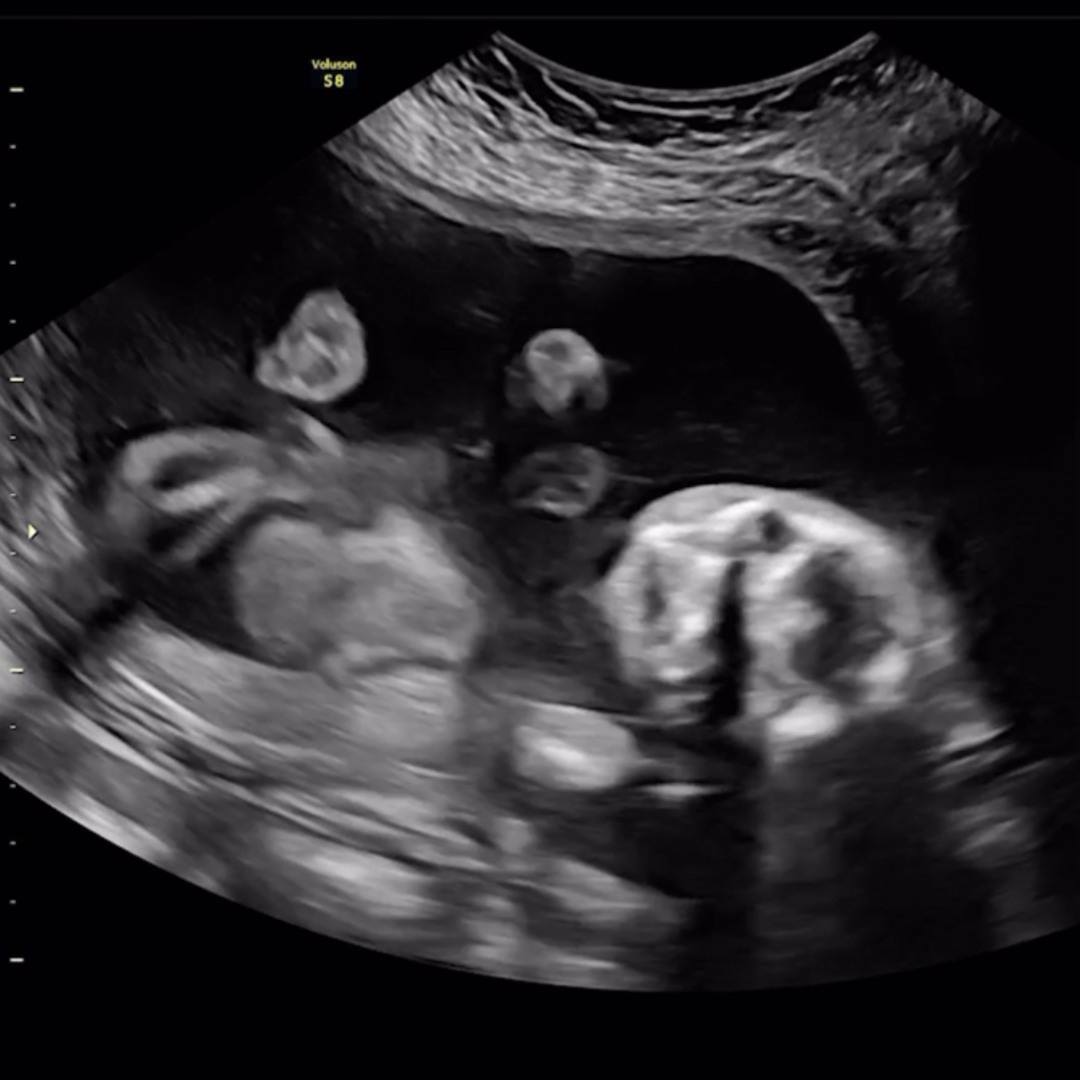 Photo shared by Bianca for their Babylist baby registry.