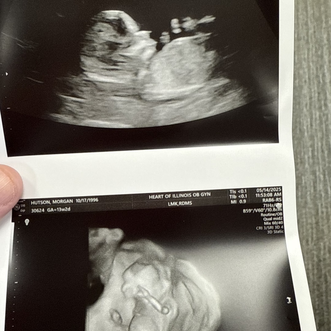 Photo shared by Morgan for their Babylist baby registry.