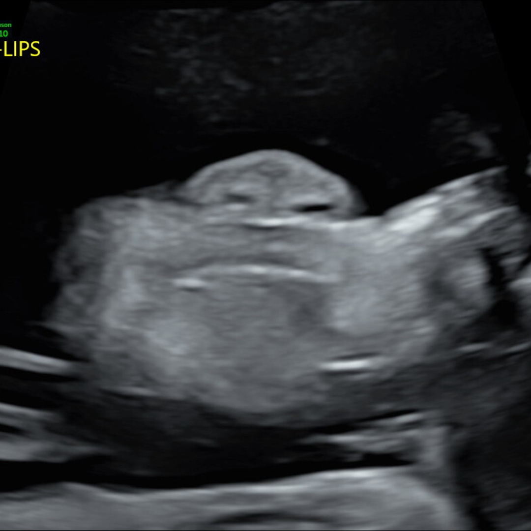Photo shared by Brittany for their Babylist baby registry.