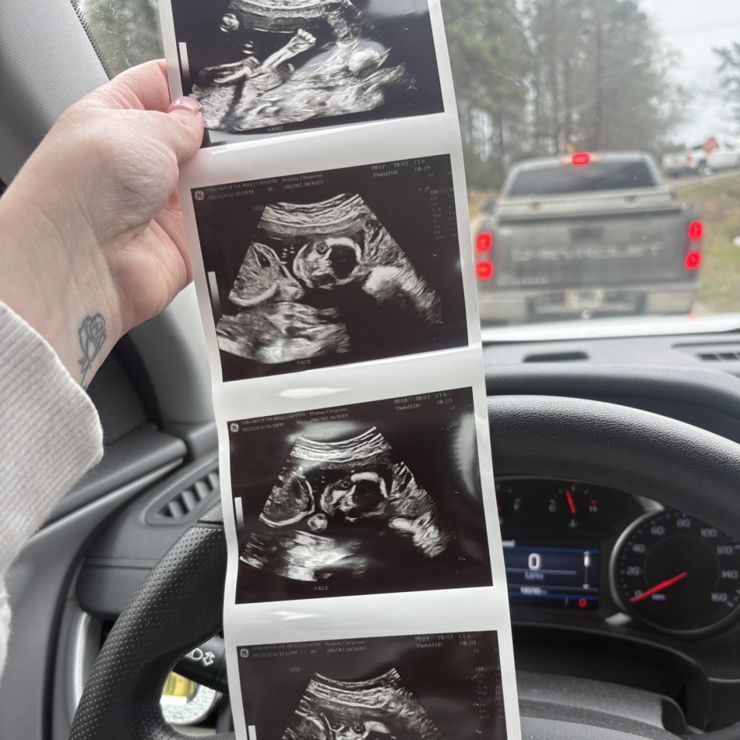 Photo shared by Cheyenne for their Babylist baby registry.