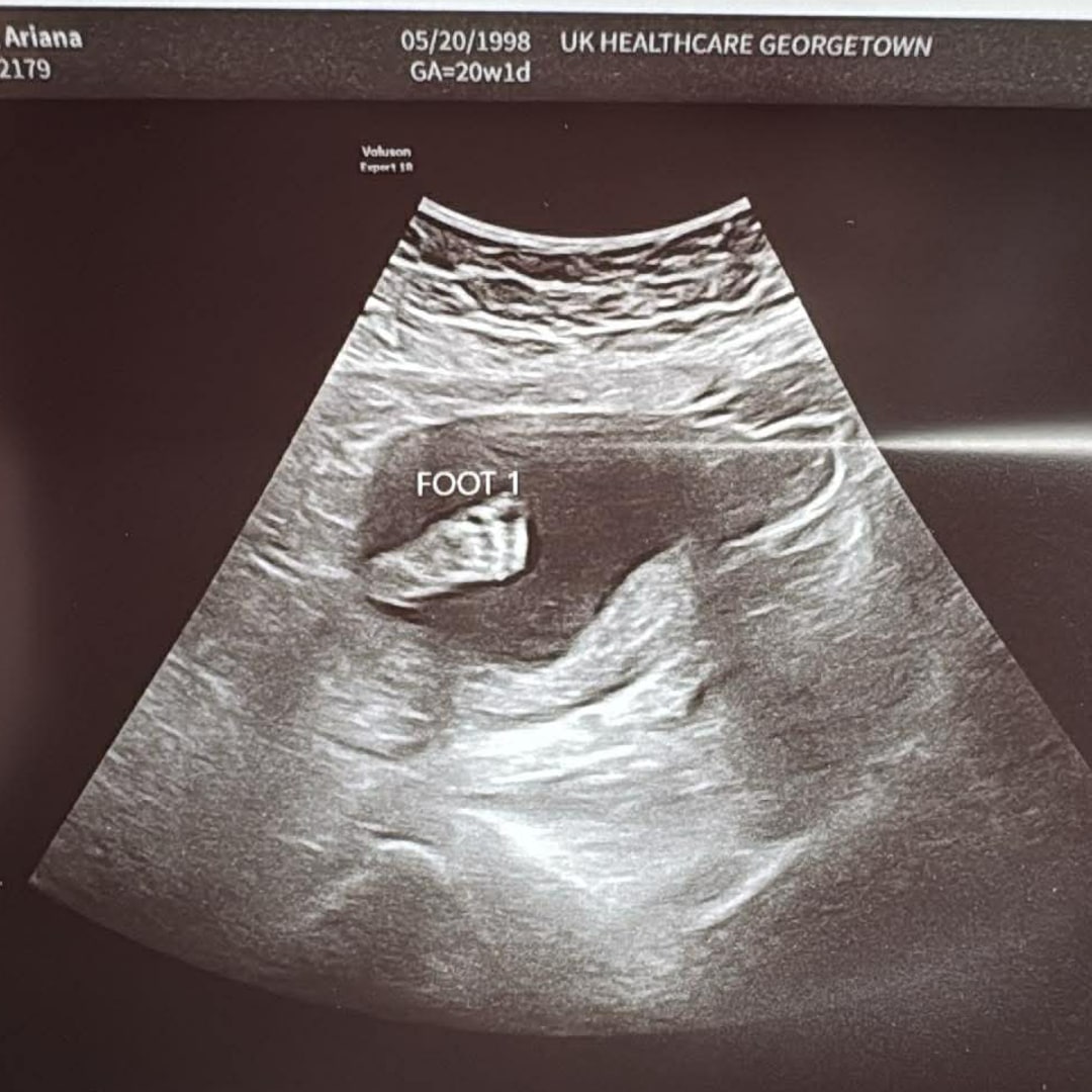 Photo shared by Ariana for their Babylist baby registry.