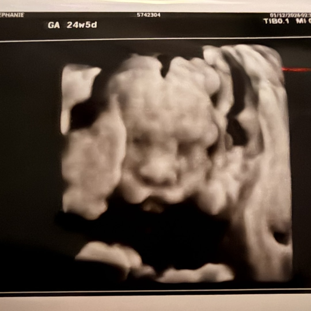 Photo shared by Stephanie for their Babylist baby registry.